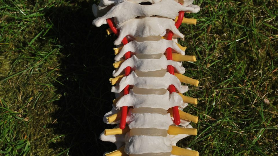 Close view of an anatomical model of the neck vertebrae with red arteries and yellow nerve roots on grass