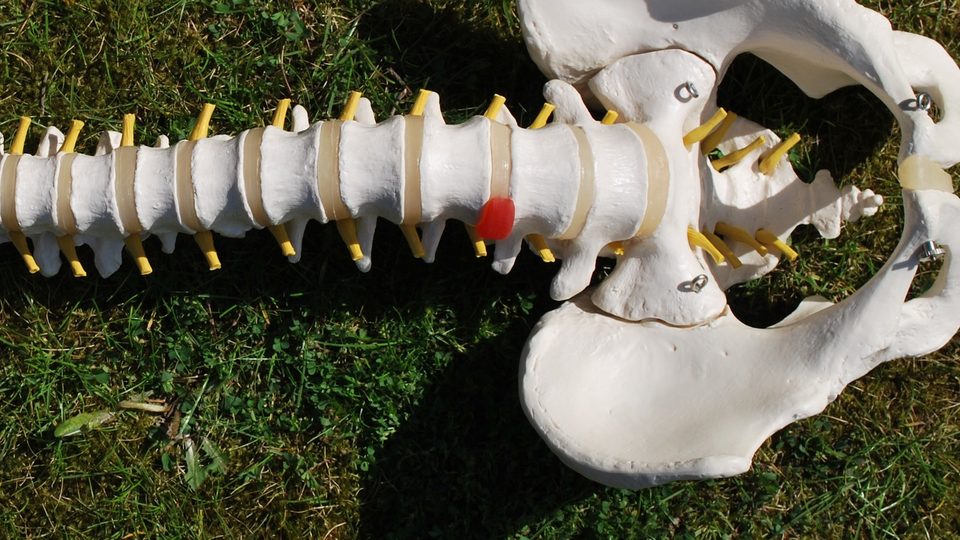 An anatomical model of the lower spine and pelvis with yellow nerve roots lying on sunlit grass